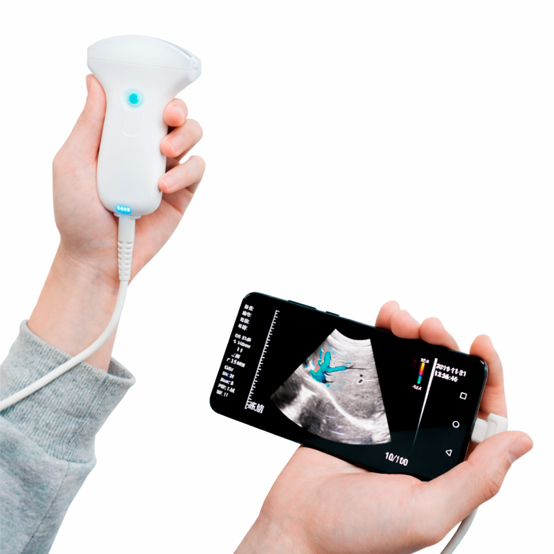 Ecografo-inalámbrico-Sonostar-Physiotecno-vista5