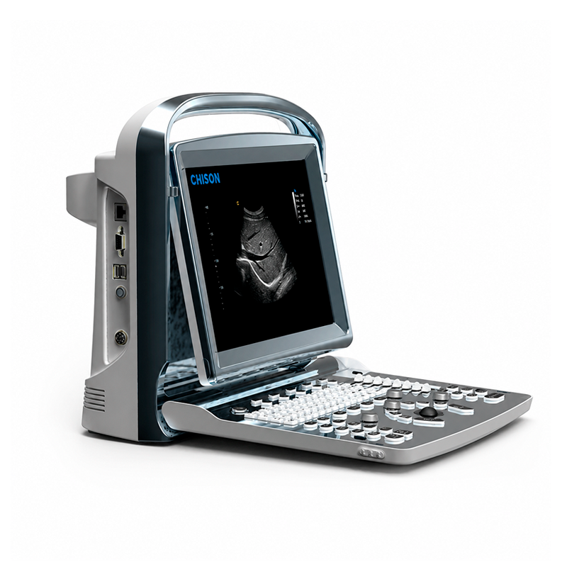 Ecógrafo Chison portátil ECO 1 con sonda lineal L7M-A