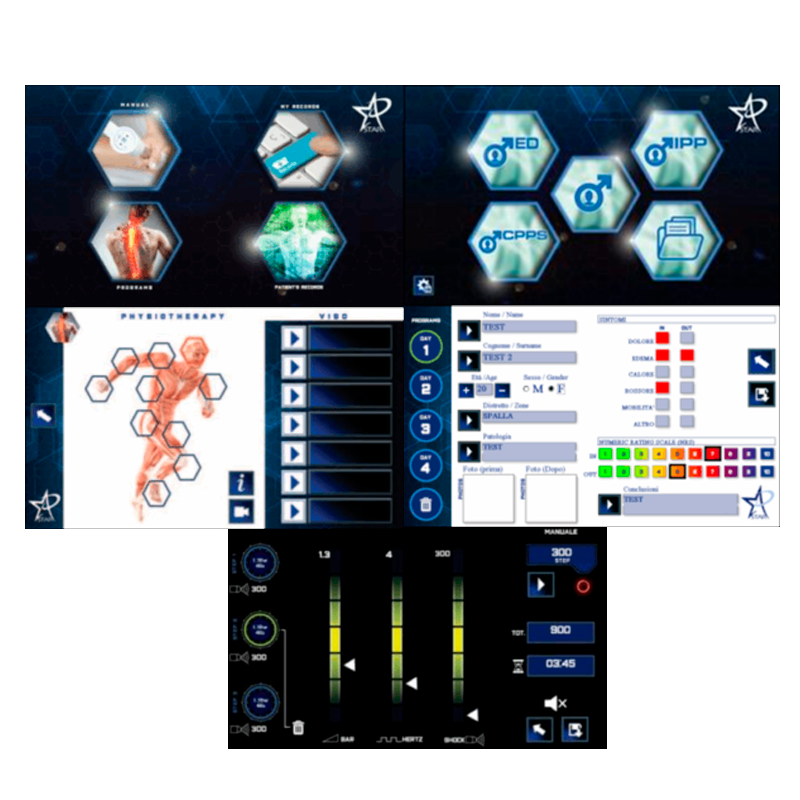 Ondas de Choque radial y focal STARWAVE + Carro STAR