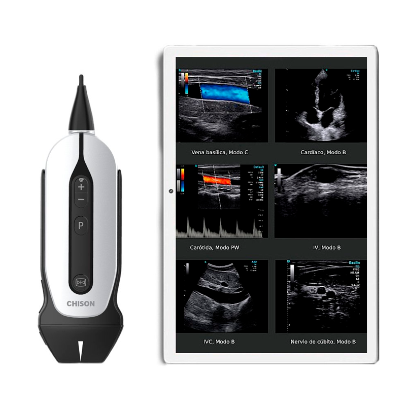 Ecógrafo Chison portátil Sonoeye con sonda lineal G2